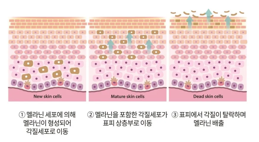 멜라닌이 각질세포로 이동해 표피 상층부로 올라가 각질과 함께 탈락하는 3단계 배출 과정을 나타낸 피부 단면 설명 이미지
