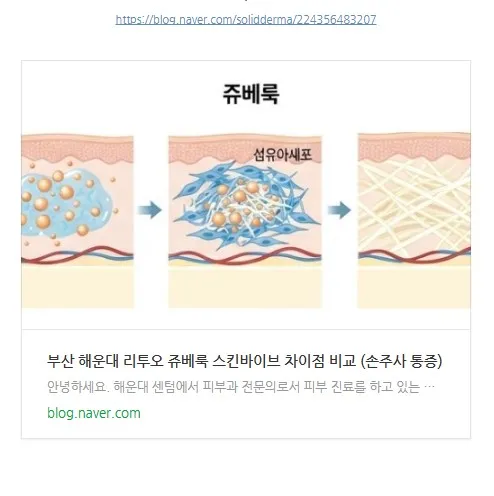 리투오 쥬베룩 스킨바이브 차이점 비교(손주사 통증) 글의 링크 미리보기 이미지