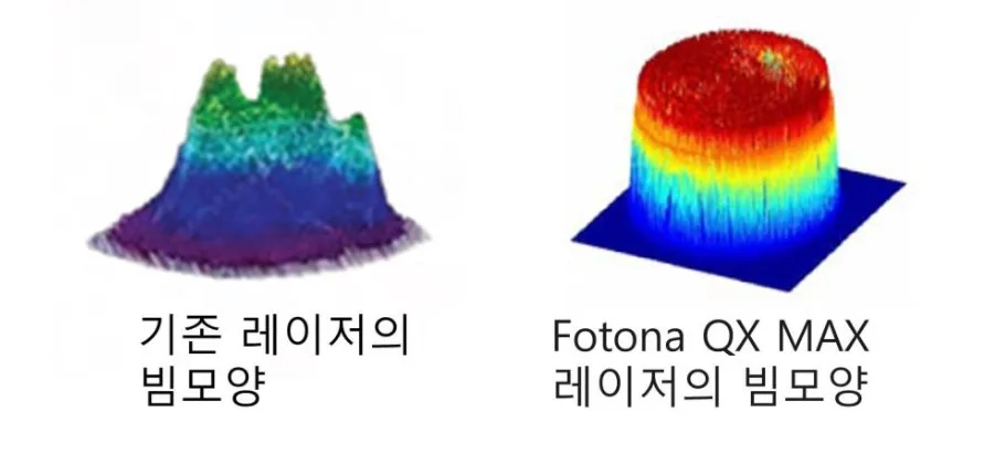 기존 레이저의 불균일한 빔 모양과 포토나 QX MAX의 평평한 빔 모양을 비교한 3D 프로파일 이미지