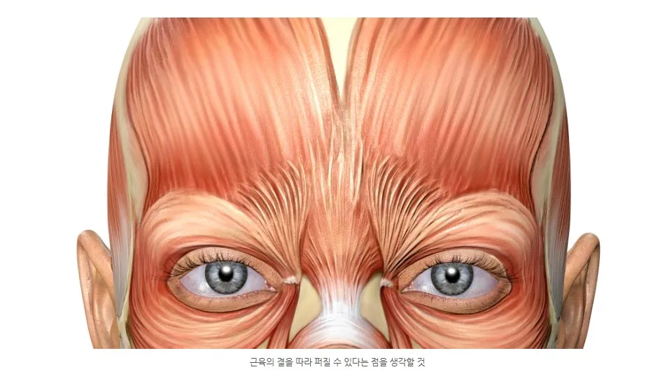 이마와 미간 주변 표정 근육의 결을 나타낸 해부 일러스트(근육의 결을 따라 약물이 퍼질 수 있음)