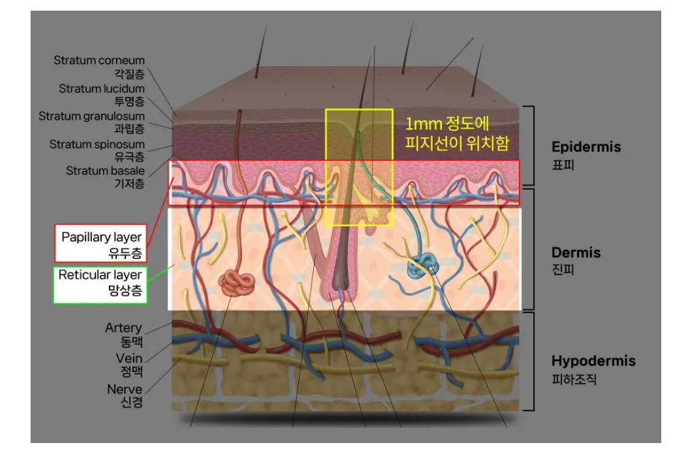 표피·유두층·망상층·피하조직 구조와 1mm 정도 깊이에 피지선이 위치함을 표시한 피부 단면 설명 이미지