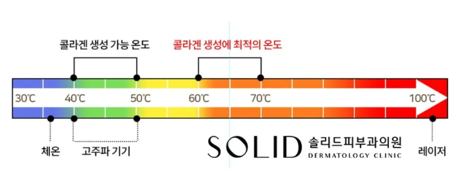 체온 30℃대부터 레이저 100℃까지의 온도 눈금 위에 콜라겐 생성 가능 온도(4050℃)와 최적 온도(6070℃), 고주파 기기 범위를 표시한 설명 이미지