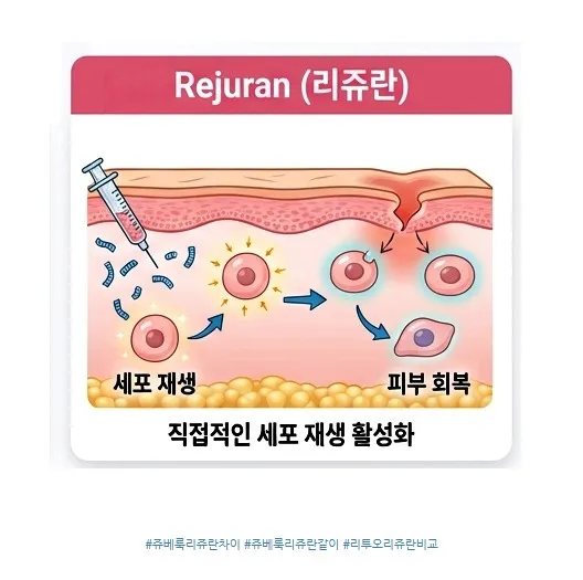 리쥬란의 PN 성분이 세포 재생을 직접 활성화해 피부를 회복시키는 과정을 나타낸 피부 단면 설명 이미지