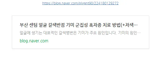 이 사례를 자세히 다룬 블로그 글(부산 센텀 얼굴 갈색반점 기미 군집성 흑자증 치료 방법)의 링크 미리보기 이미지