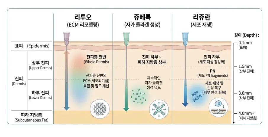 리투오(진피층 전반), 쥬베룩(진피 하부~피하 지방층 상부), 리쥬란(진피 하부)의 주입 깊이를 표피부터 피하 지방층까지 mm 단위로 비교한 설명 이미지