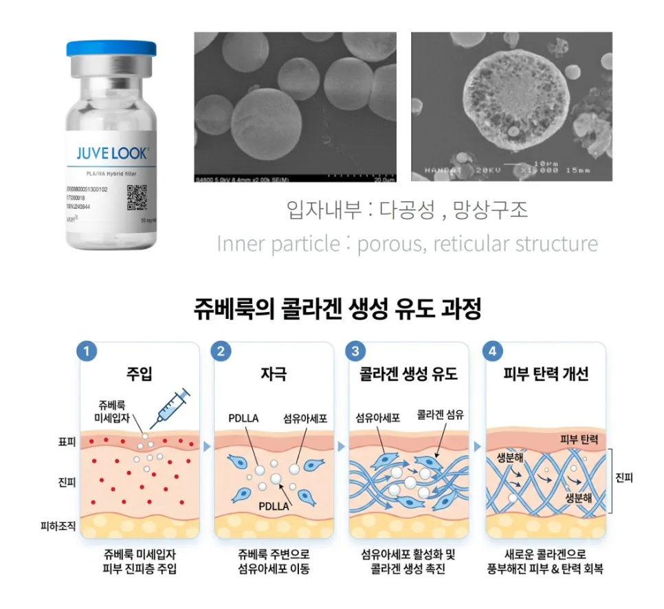 쥬베룩 바이알과 다공성 망상구조 입자의 전자현미경 사진, 주입·자극·콜라겐 생성 유도·탄력 개선 4단계를 나타낸 설명 이미지