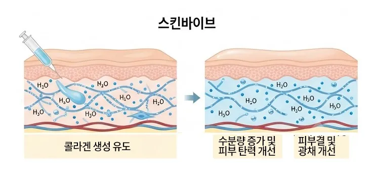 스킨바이브 주입 후 수분량 증가와 피부 탄력·결·광채 개선으로 이어지는 과정을 나타낸 피부 단면 설명 이미지