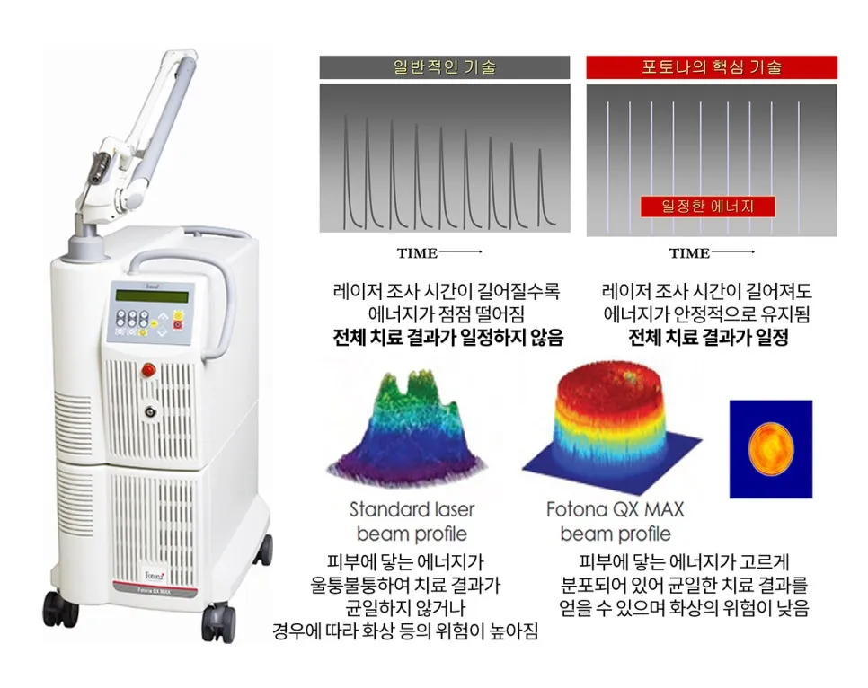 포토나 QX-MAX 장비와 시간에 따른 에너지 안정성, 플랫 빔 프로파일을 일반 레이저와 비교한 설명 이미지