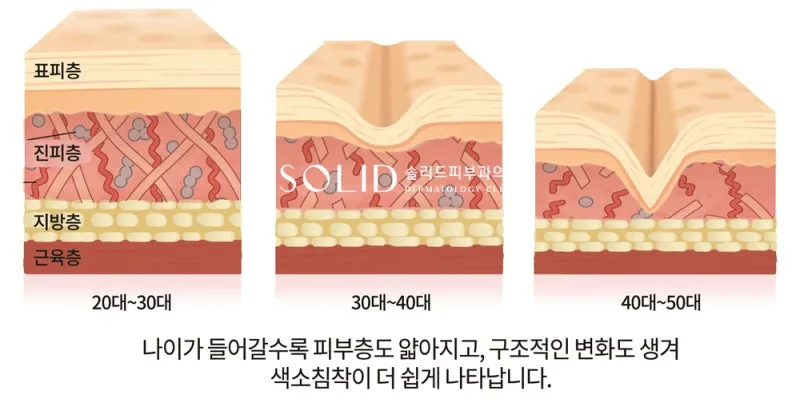 2030대, 3040대, 40~50대로 갈수록 표피·진피·지방층이 얇아지고 구조가 변하는 모습을 나타낸 단면 설명 이미지